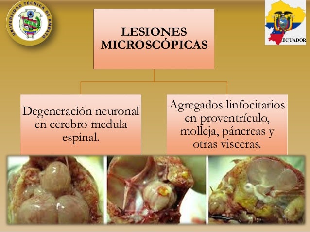 encefalomielitis aviar